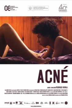 Acné  (2008)